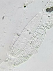 Coprinopsis mitrispora