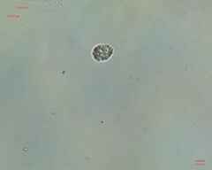 Cercozoa