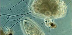 Allogromia terricola