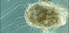 Allogromia terricola