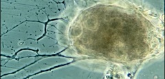 Allogromia terricola