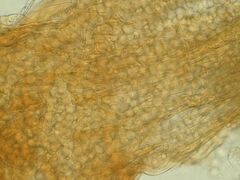Arcyria cinerea