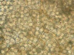 Arcyria cinerea