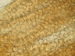 Arcyria cinerea