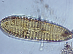 Surirella