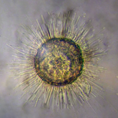 Acanthocystis