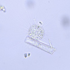 Heliozoa