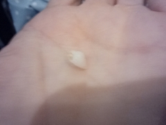 Gastropoda