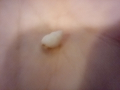 Gastropoda