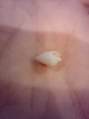Gastropoda