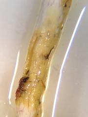 Cladonia ecmocyna occidentalis