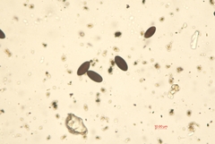 Biscogniauxia mediterranea