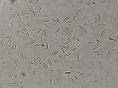 Lepiota spheniscispora