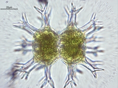 Staurastrum arctiscon