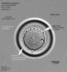 Hyalodiscus scoticus