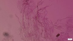 Henningsomyces candidus