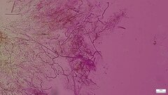 Henningsomyces candidus