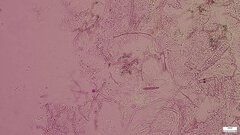 Henningsomyces candidus