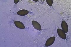 Podospora pleiospora