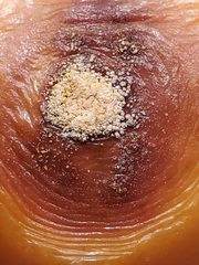 Colletotrichum coccodes