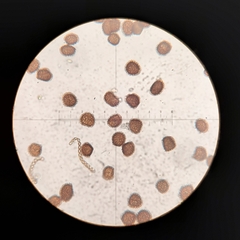 Fossombronia wondraczekii