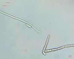 Ulotrichales