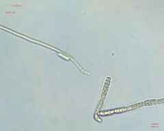 Ulotrichales