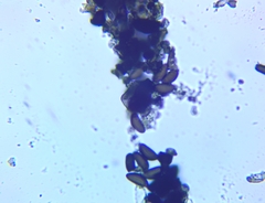 Annulohypoxylon annulatum