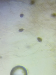 Panaeolus subbalteatus