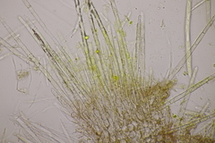 Trichopeziza sulphurea