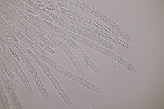 Trichopeziza sulphurea