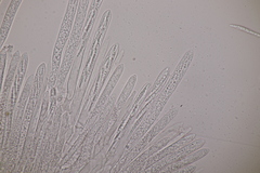 Trichopeziza sulphurea
