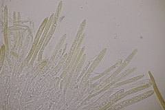 Trichopeziza sulphurea
