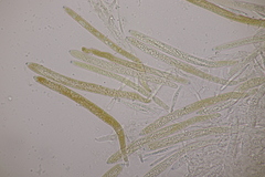 Trichopeziza sulphurea