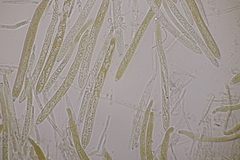 Trichopeziza sulphurea