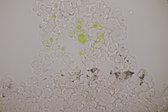 Erythricium aurantiacum