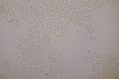 Erythricium aurantiacum