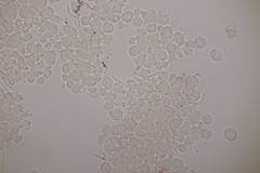 Erythricium aurantiacum