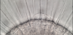 Actinosphaerium eichhornii