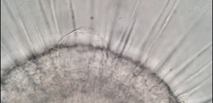 Actinosphaerium eichhornii