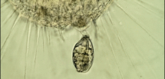 Actinosphaerium eichhornii