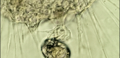 Actinosphaerium eichhornii
