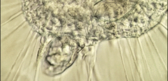 Actinosphaerium eichhornii