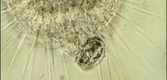 Actinosphaerium eichhornii