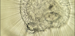 Actinosphaerium eichhornii