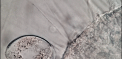 Actinosphaerium eichhornii