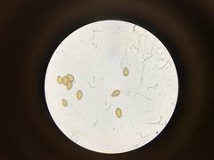 Bolbitius reticulatus