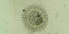 Actinosphaerium eichhornii