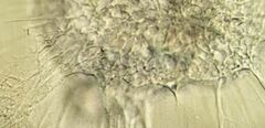 Actinosphaerium eichhornii