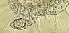 Actinosphaerium eichhornii